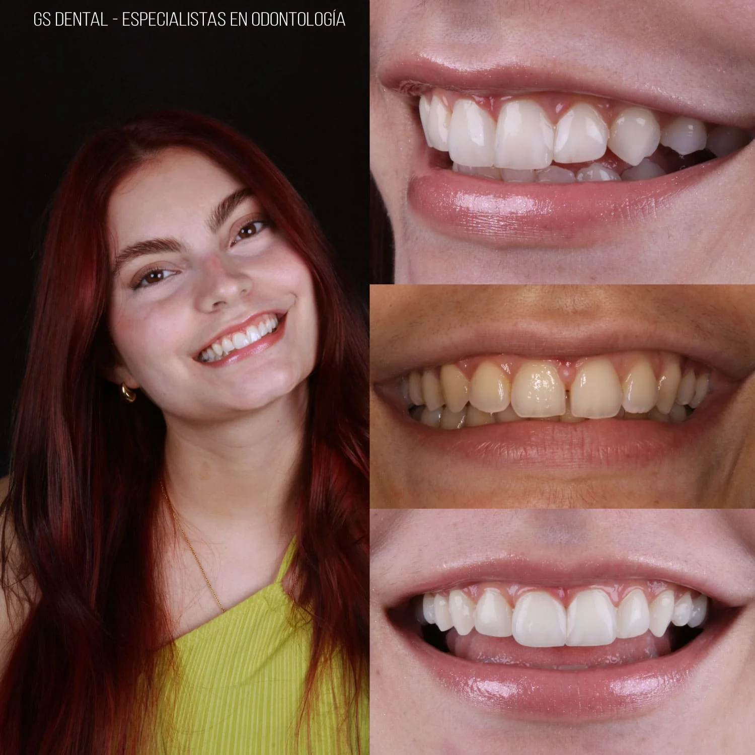 Diseño de Sonrisa