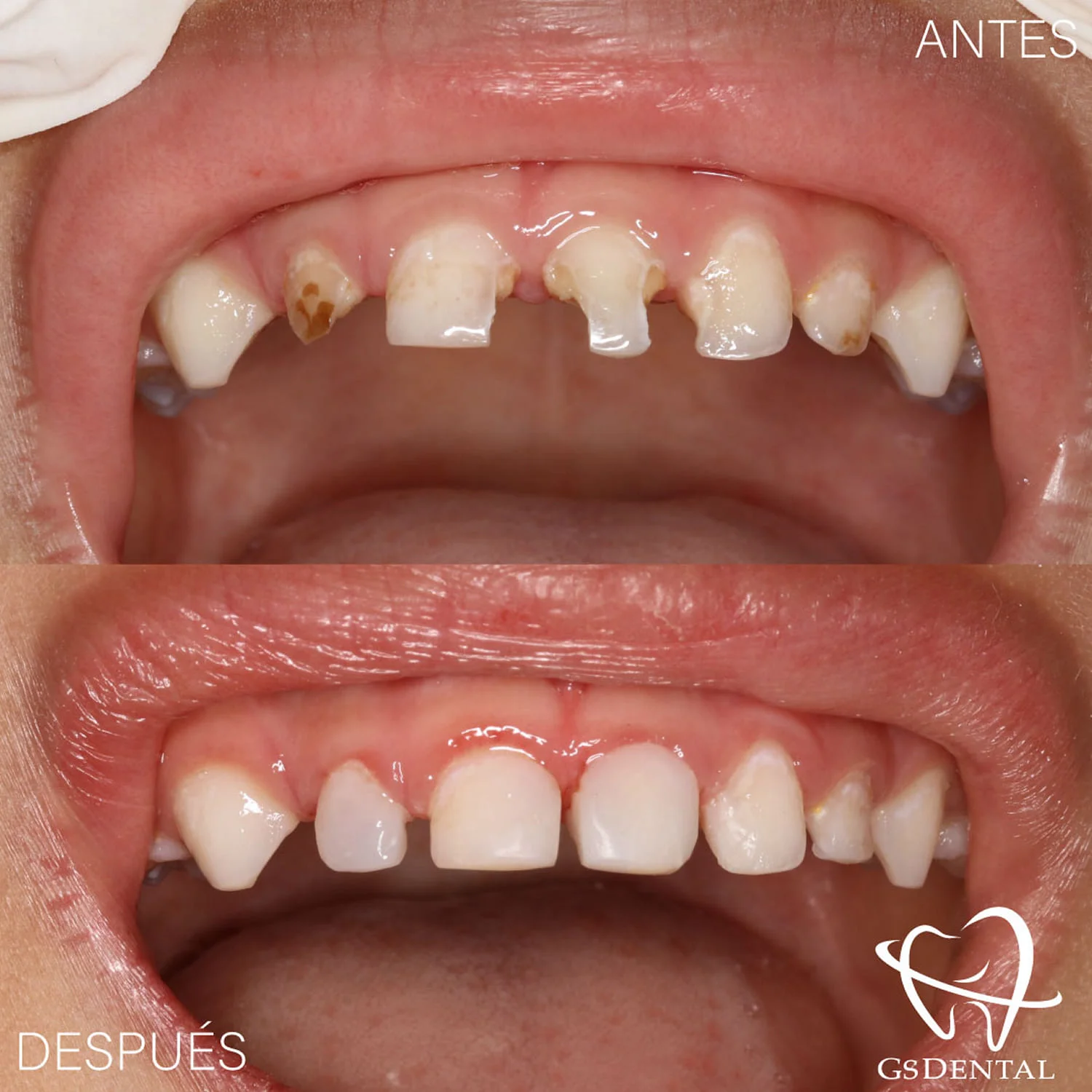 Odontopediatría